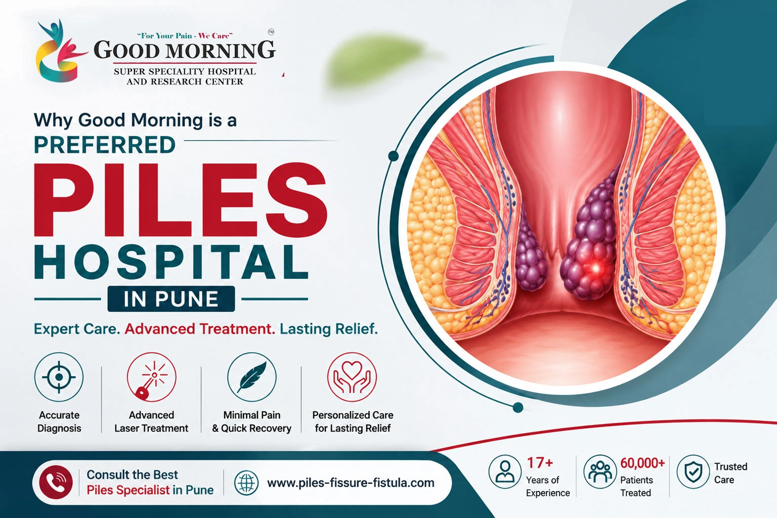 Best Piles Hospital in Pune - Good Morning Superspeciality Hospital